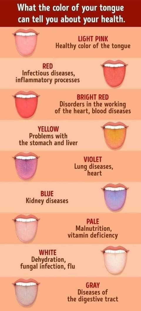 What your tongue color says about your health